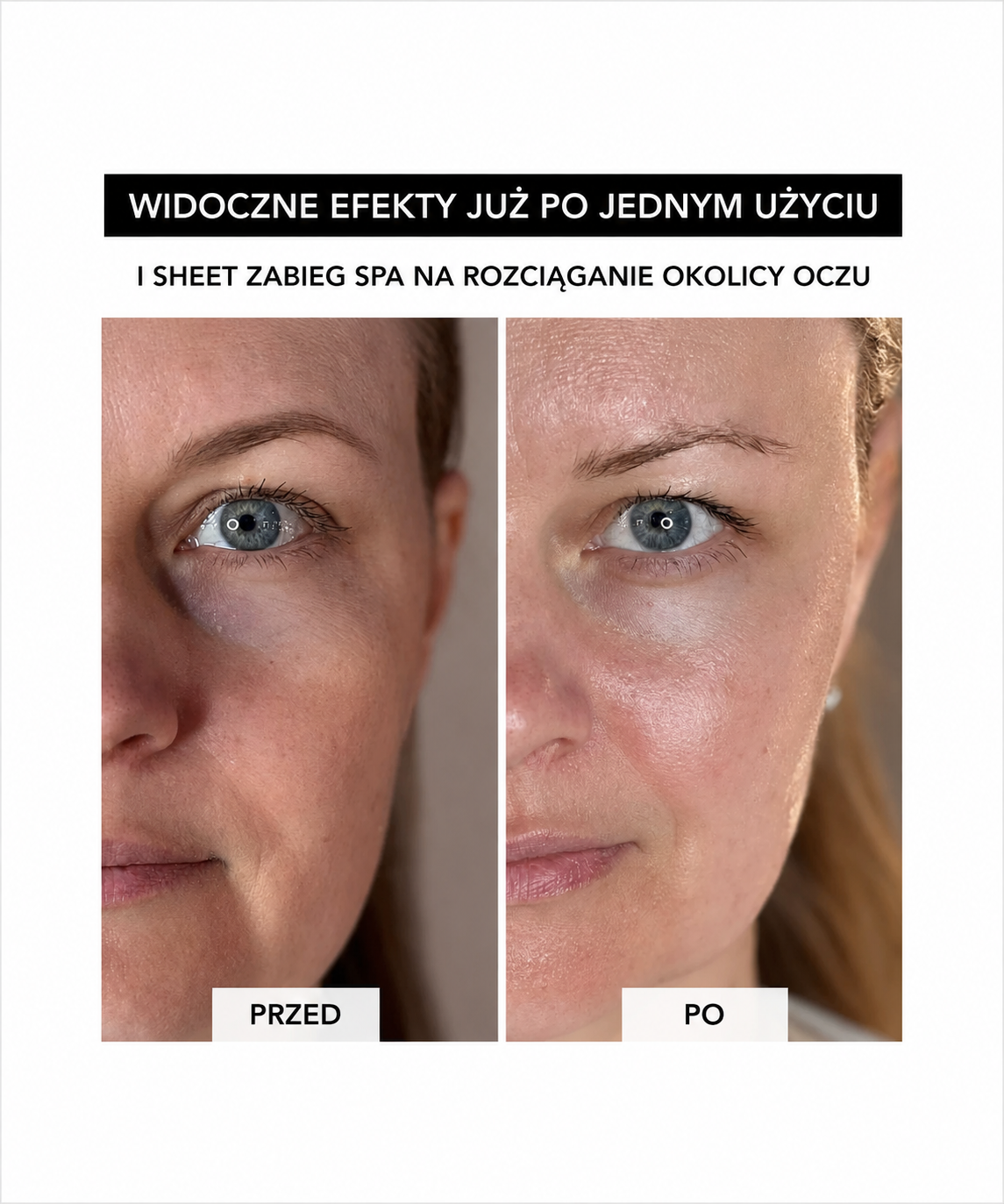 Spa Treatment NMN Sheet Mask – maska w płachcie z NMN do głębokiej regeneracji i odmłodzenia skóry*