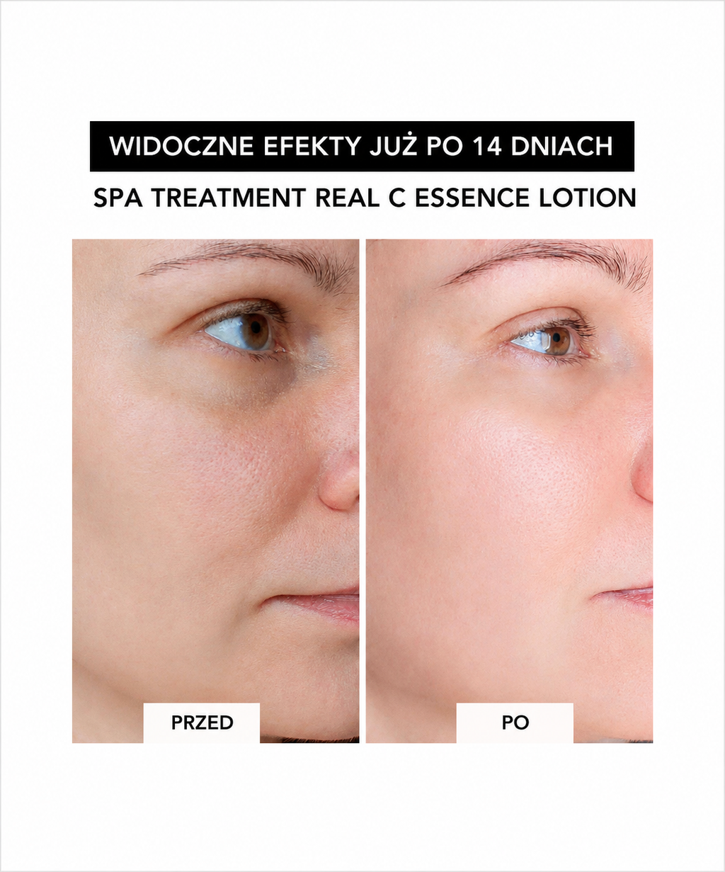 Real C-essence lotion - nawilżający lotion z 5% witaminą C, niacynamidem i retinolem