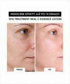 Real C-essence lotion - nawilżający lotion z 5% witaminą C, niacynamidem i retinolem