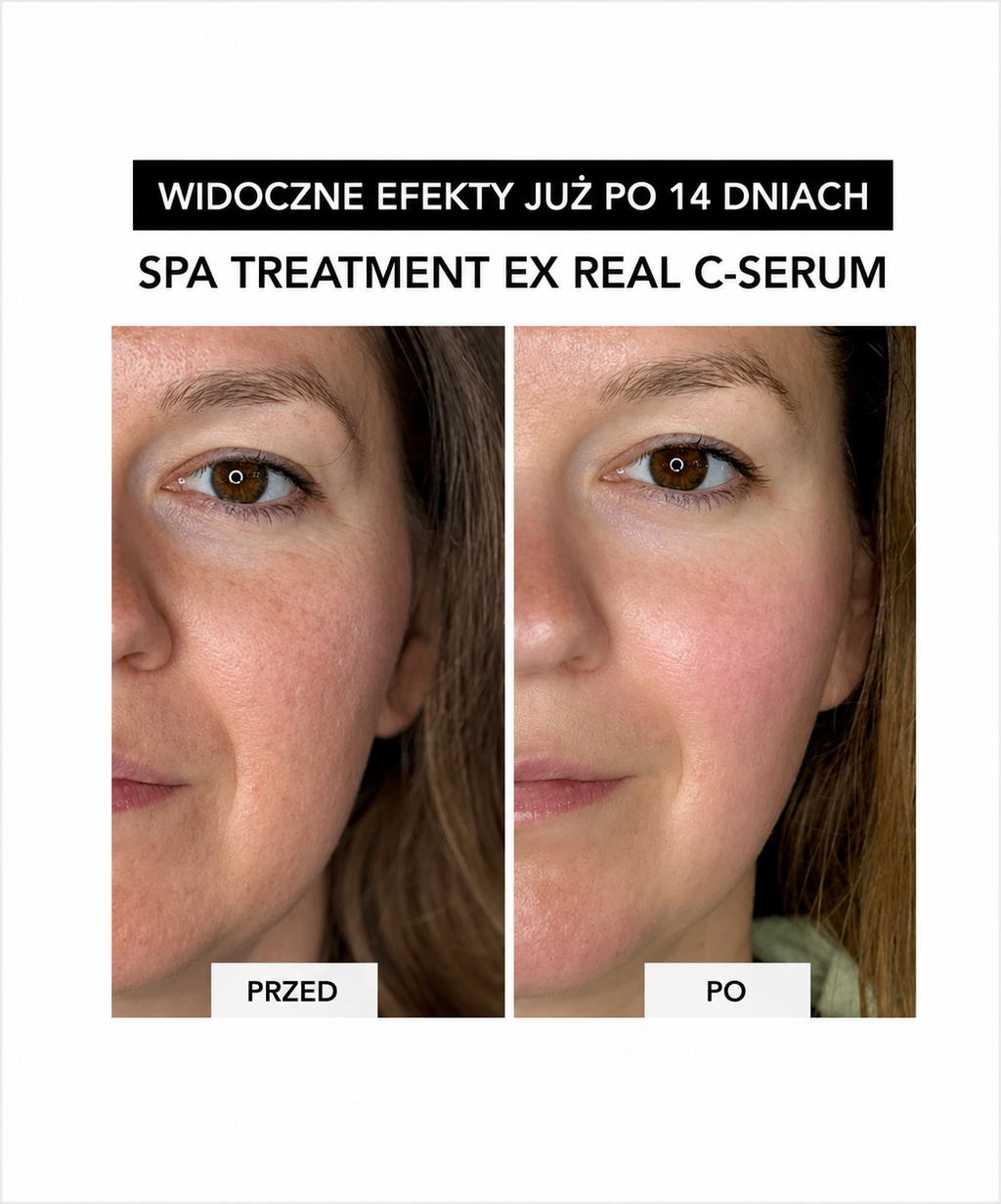 Spa Treatment Real C-Serum –  z czystą witaminą C dla rozświetlenia i odmłodzenia skóry*