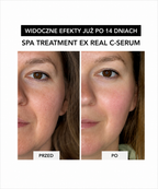Spa Treatment Real C-Serum –  z czystą witaminą C dla rozświetlenia i odmłodzenia skóry*