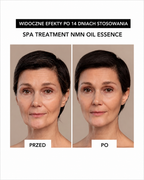eX Loose Spickle & NMN Sheet Mask - Intensywna 4-tygodniowa kuracja ujędrniająca skórę