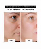 “VITAMIN & COLLAGEN DUO SET” -