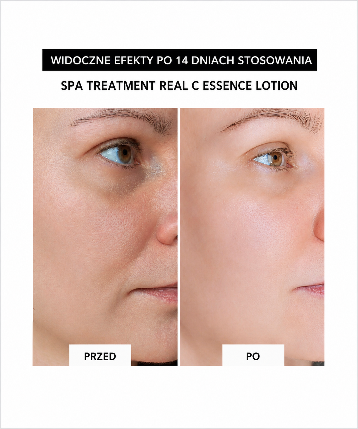 “VITAMIN & COLLAGEN DUO SET” -