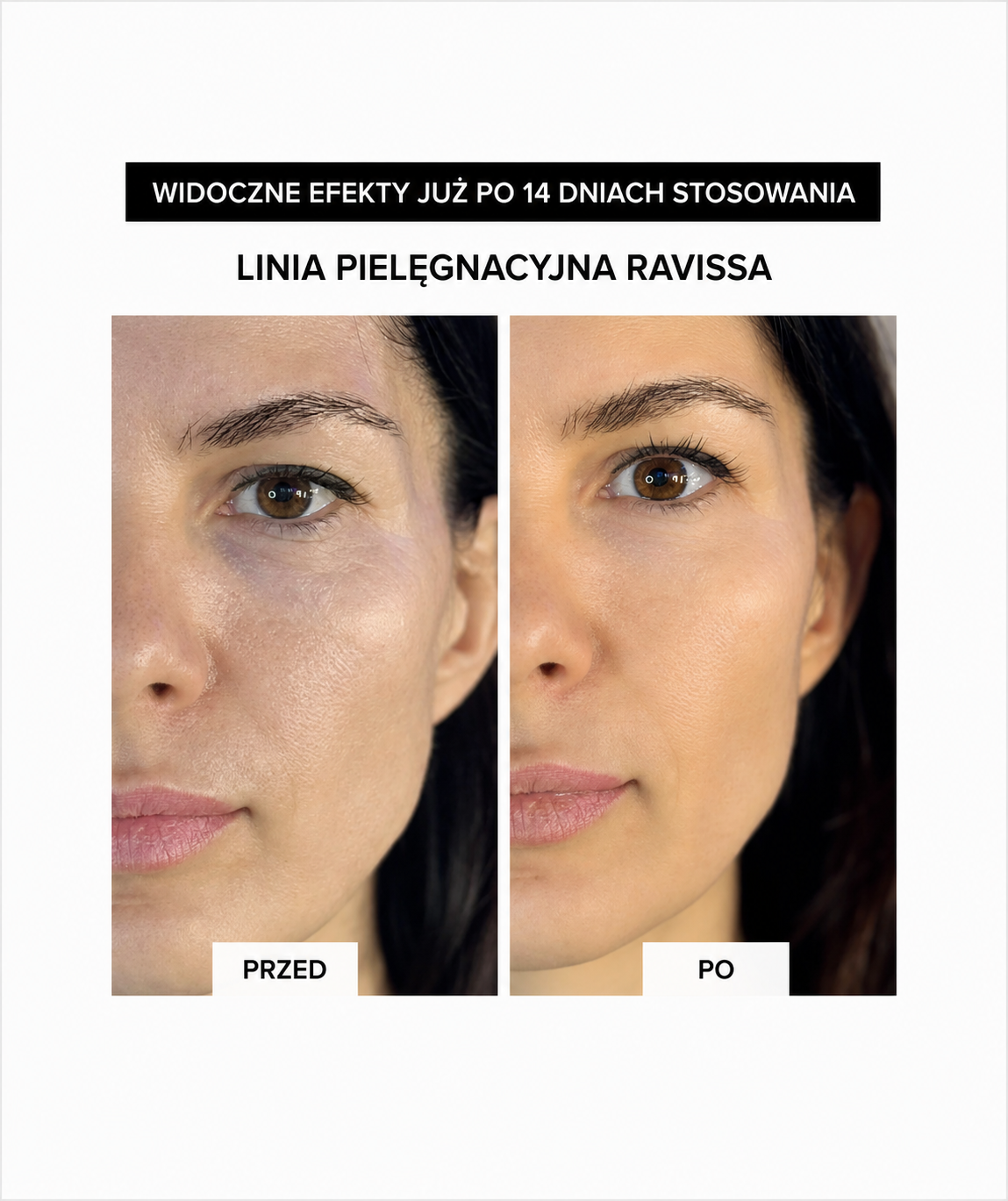 Ravissa Moist Surge Lotion III+ - Lotion do przywracania naturalnych mechanizmów nawilżenia skóry*