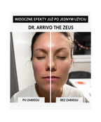 Dr. Arrivo Zeus II Pink - Urządzenie kosmetyczne premium*