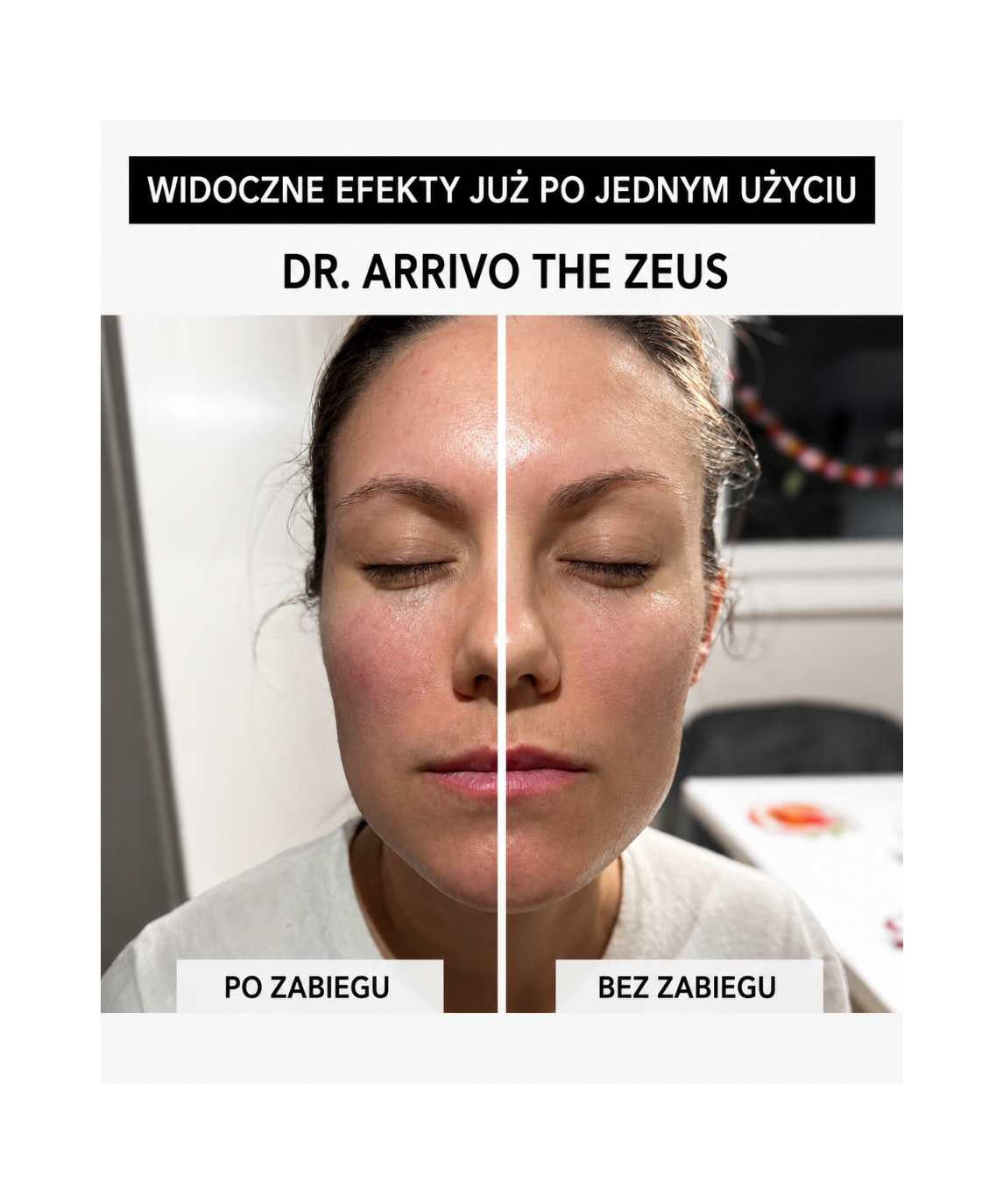 Dr. Arrivo Zeus II Pink - Urządzenie kosmetyczne premium*