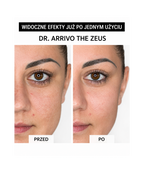 Dr. Arrivo Zeus II Pink - Urządzenie kosmetyczne premium*