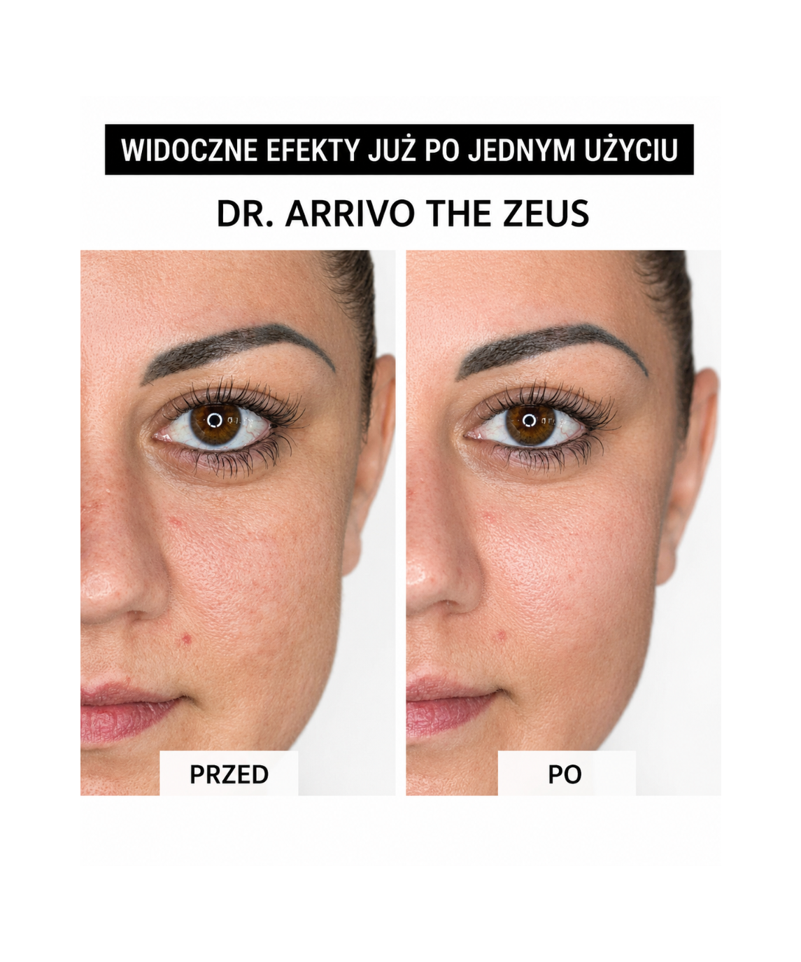 Dr. Arrivo Zeus II Pink - Urządzenie kosmetyczne premium*