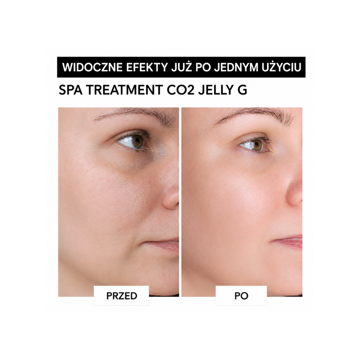 Spa Treatment CO2 Jelly G - luksusowa japońska maska karboksyterapeutyczna*