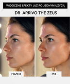 Dr. Arrivo Zeus IV - Luxsusowe urządzenie kosmetyczne nowej generacji*