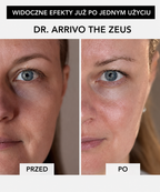 Dr. Arrivo Zeus IV - Luxsusowe urządzenie kosmetyczne nowej generacji*