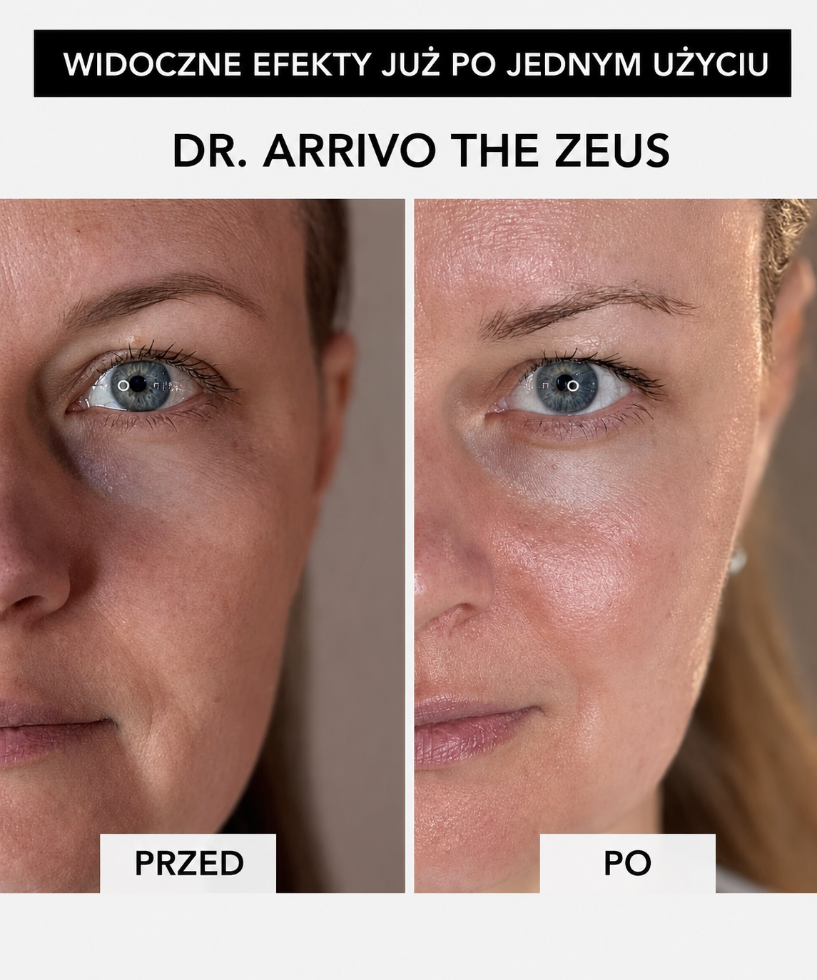 Dr. Arrivo Zeus IV - Luxsusowe urządzenie kosmetyczne nowej generacji*