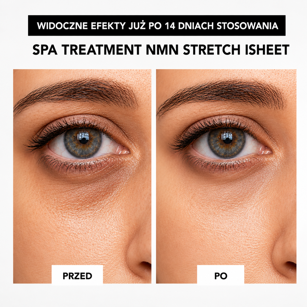 Spa Treatment NMN Duo Set - NMN – Rytuał blasku i jędrności skóry*