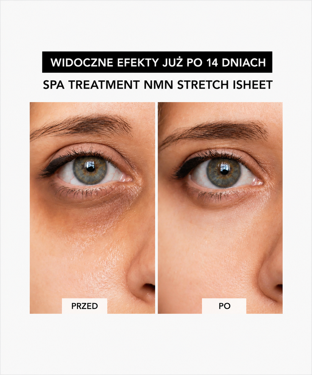 Spa Treatment UMB Stretch iSheet – płatki anti-age z kompleksem peptydów jadu węża*
