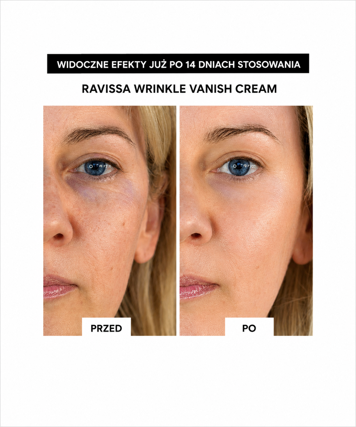 Skin Scientist Wrinkle Vanish Cream Sheet - Kremowe płatki z efektem anti-age*